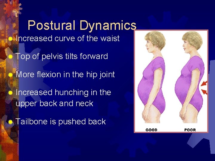 Postural Dynamics ® Increased ® Top curve of the waist of pelvis tilts forward