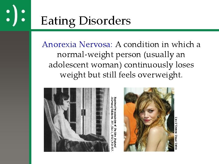 Eating Disorders Anorexia Nervosa: A condition in which a normal-weight person (usually an adolescent