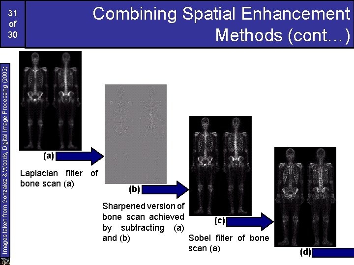 Combining Spatial Enhancement Methods (cont…) Images taken from Gonzalez & Woods, Digital Image Processing