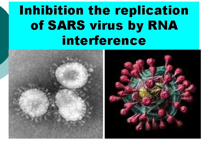 Inhibition the replication of SARS virus by RNA interference 