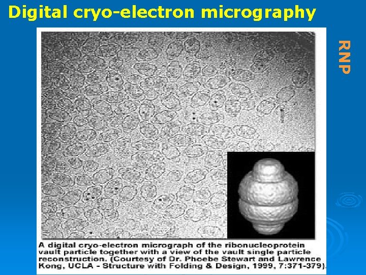 Digital cryo-electron micrography RNP 