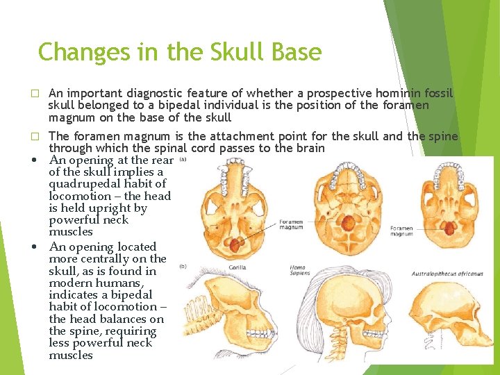 Changes in the Skull Base � An important diagnostic feature of whether a prospective Changes in the Skull Base � An important diagnostic feature of whether a prospective