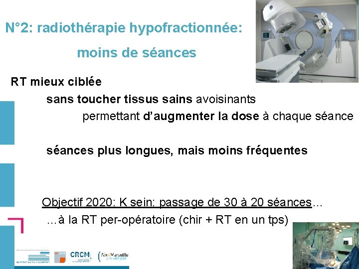 N° 2: radiothérapie hypofractionnée: moins de séances RT mieux ciblée sans toucher tissus sains