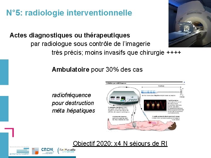 N° 5: radiologie interventionnelle Actes diagnostiques ou thérapeutiques par radiologue sous contrôle de l’imagerie