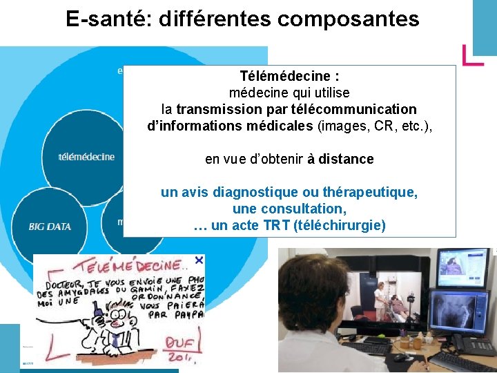 E-santé: différentes composantes Télémédecine : médecine qui utilise la transmission par télécommunication d’informations médicales