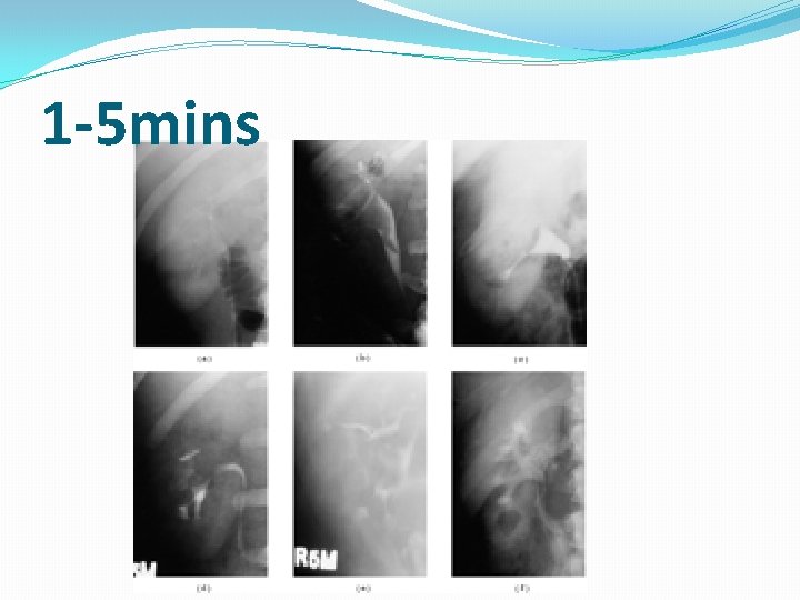 1 -5 mins 1 -5 mins