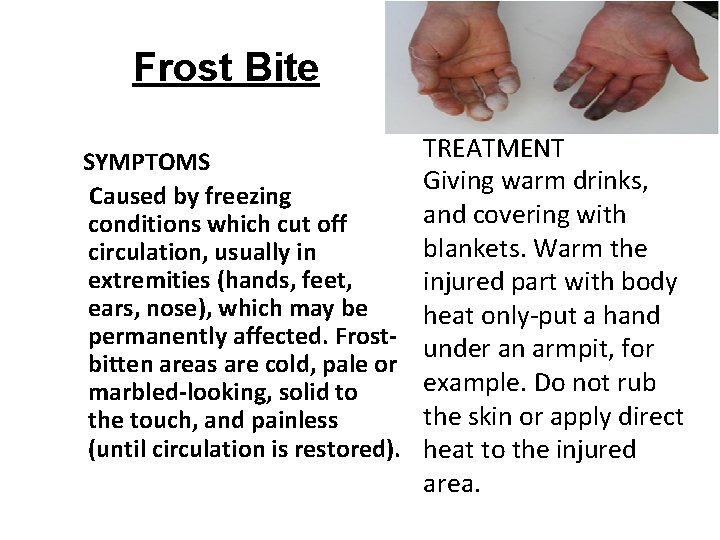 Frost Bite SYMPTOMS Caused by freezing conditions which cut off circulation, usually in extremities