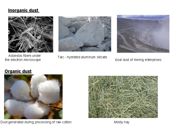 Inorganic dust Asbestos fibers under the electron microscope Talc - hydrated aluminum silicate Сoal