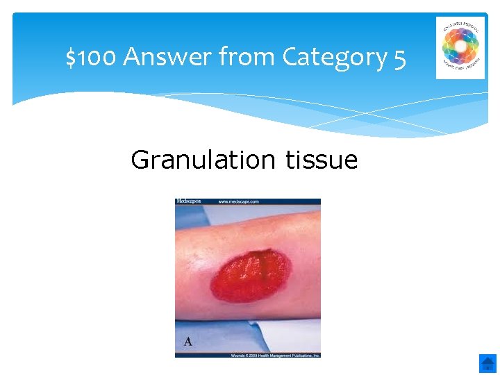 $100 Answer from Category 5 Granulation tissue 