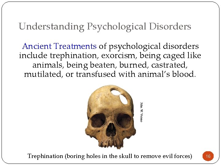 Understanding Psychological Disorders Ancient Treatments of psychological disorders include trephination, exorcism, being caged like