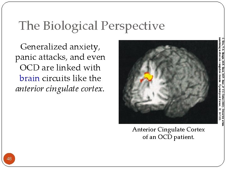 The Biological Perspective Anterior Cingulate Cortex of an OCD patient. 48 S. Ursu, V.