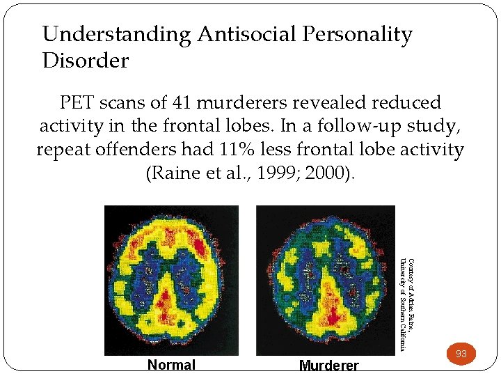 Understanding Antisocial Personality Disorder PET scans of 41 murderers revealed reduced activity in the