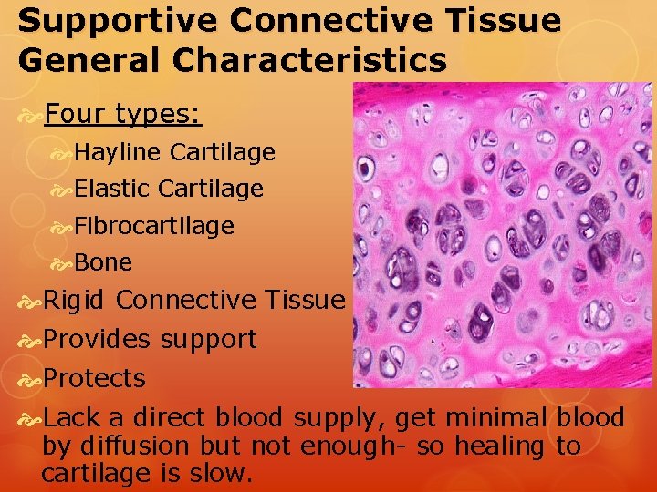 Supportive Connective Tissue General Characteristics Four types: Hayline Cartilage Elastic Cartilage Fibrocartilage Bone Rigid