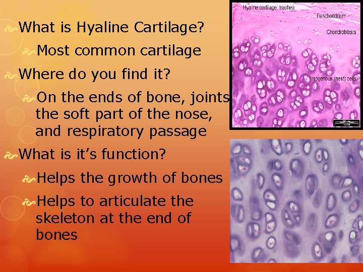  What is Hyaline Cartilage? Most common cartilage Where do you find it? On