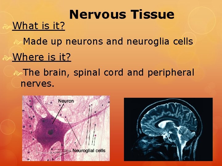  What is it? Nervous Tissue Made up neurons and neuroglia cells Where is
