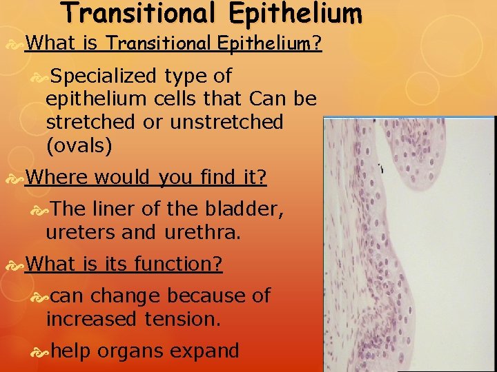 Transitional Epithelium What is Transitional Epithelium? Specialized type of epithelium cells that Can be