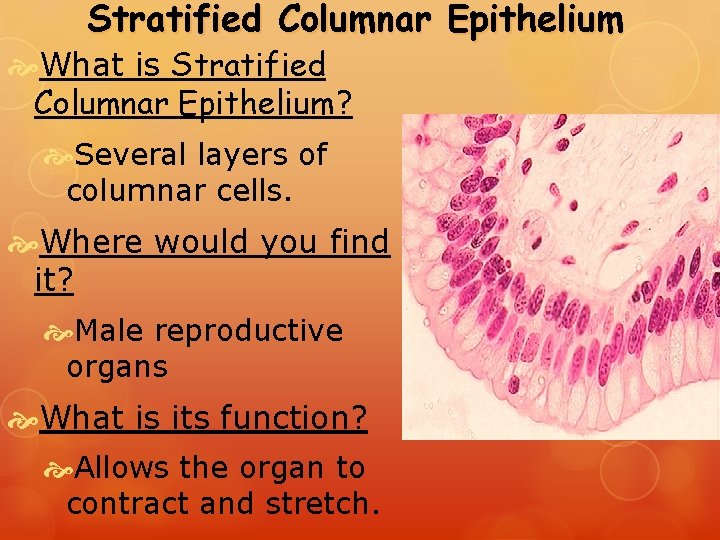 Stratified Columnar Epithelium What is Stratified Columnar Epithelium? Several layers of columnar cells. Where