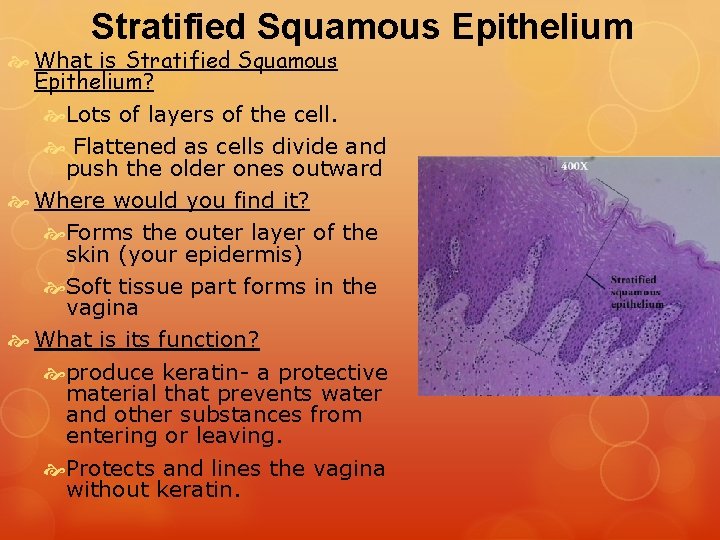 Stratified Squamous Epithelium What is Stratified Squamous Epithelium? Lots of layers of the cell. Stratified Squamous Epithelium What is Stratified Squamous Epithelium? Lots of layers of the cell.