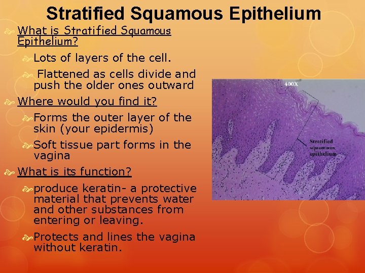 Stratified Squamous Epithelium What is Stratified Squamous Epithelium? Lots of layers of the cell.