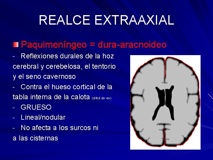 REALCE EXTRAAXIAL Paquimeníngeo = dura-aracnoideo - Reflexiones durales de la hoz cerebral y cerebelosa, REALCE EXTRAAXIAL Paquimeníngeo = dura-aracnoideo - Reflexiones durales de la hoz cerebral y cerebelosa,