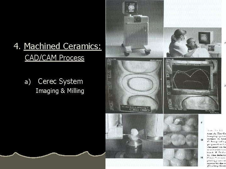 4. Machined Ceramics: CAD/CAM Process a) Cerec System Imaging & Milling 