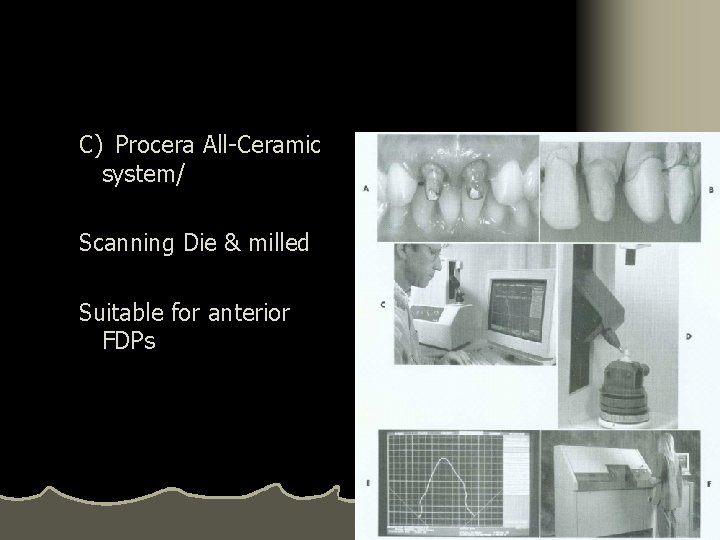 C) Procera All-Ceramic system/ Scanning Die & milled Suitable for anterior FDPs 