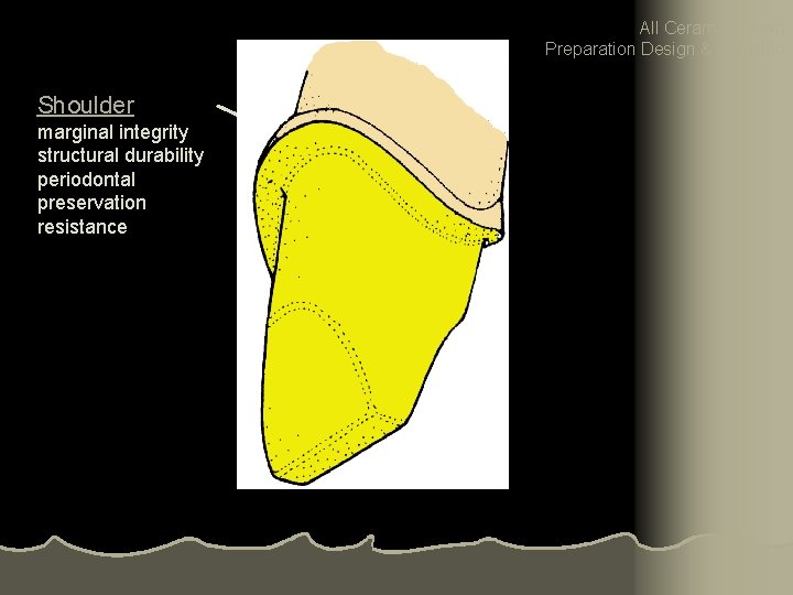 All Ceramic Crown Preparation Design & Function Shoulder marginal integrity structural durability periodontal preservation