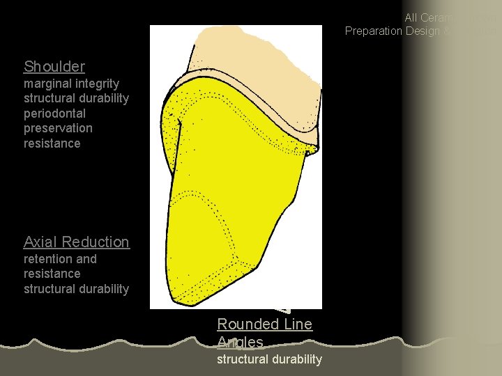 All Ceramic Crown Preparation Design & Function Shoulder marginal integrity structural durability periodontal preservation