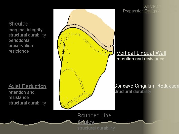 All Ceramic Crown Preparation Design & Function Shoulder marginal integrity structural durability periodontal preservation