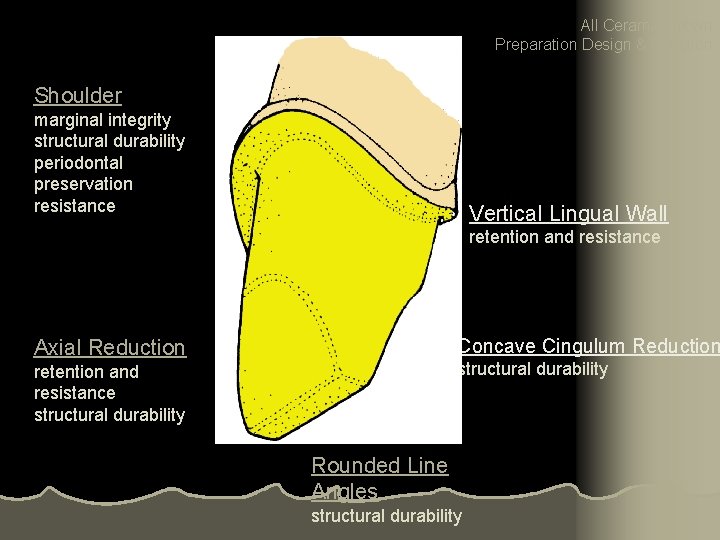 All Ceramic Crown Preparation Design & Function Shoulder marginal integrity structural durability periodontal preservation