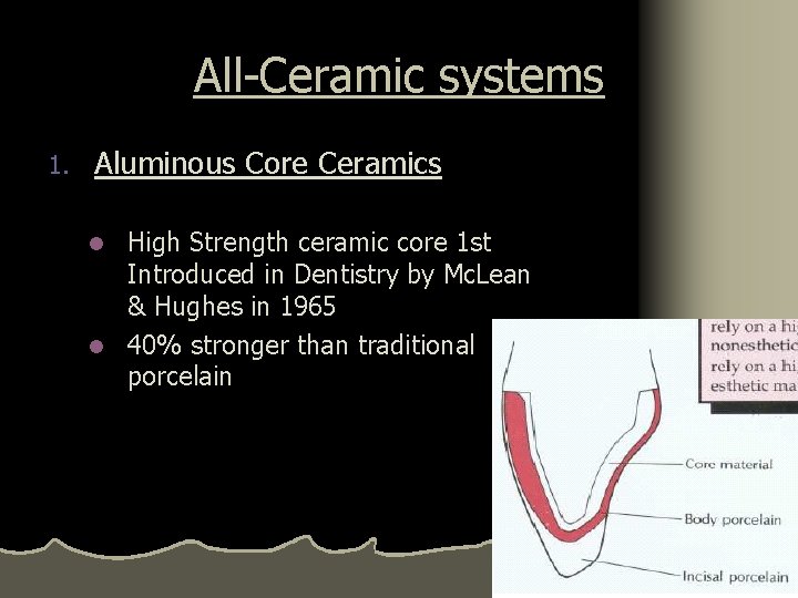 All-Ceramic systems 1. Aluminous Core Ceramics High Strength ceramic core 1 st Introduced in