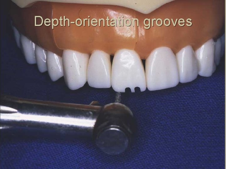 Depth-orientation grooves 