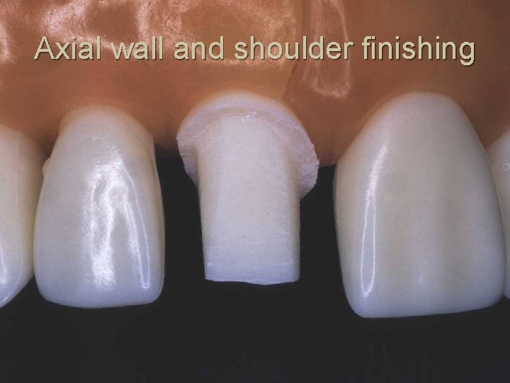 Axial wall and shoulder finishing 