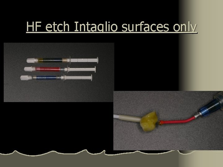 HF etch Intaglio surfaces only 