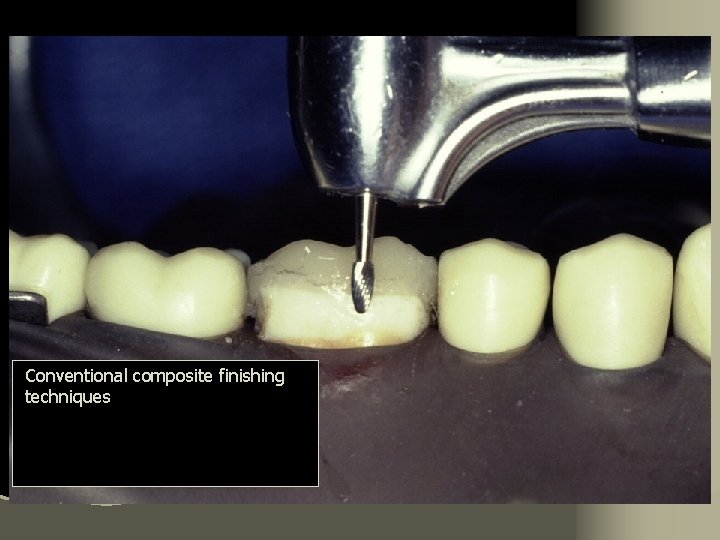 Conventional composite finishing techniques 