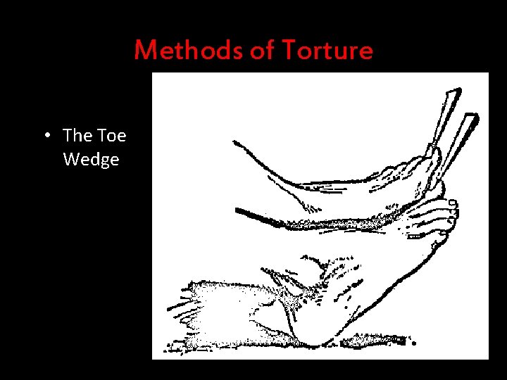 Methods of Torture • The Toe Wedge 