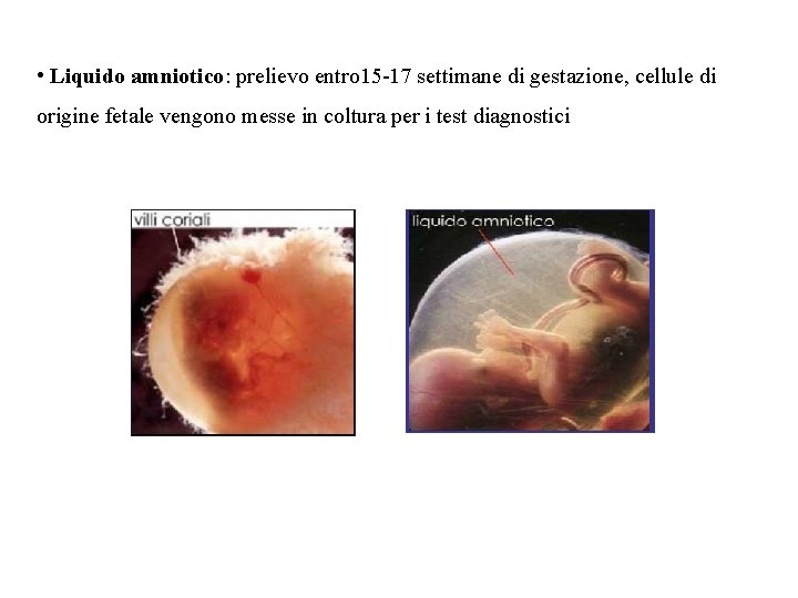  • Liquido amniotico: prelievo entro 15 -17 settimane di gestazione, cellule di origine