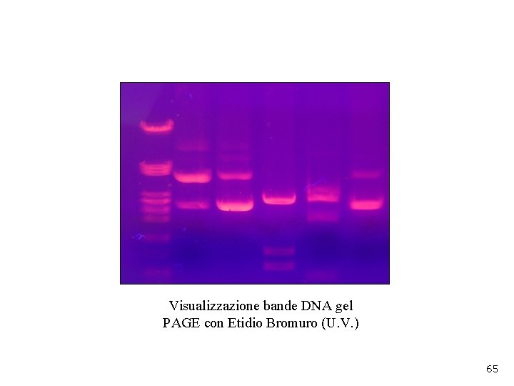 Visualizzazione bande DNA gel PAGE con Etidio Bromuro (U. V. ) 65 