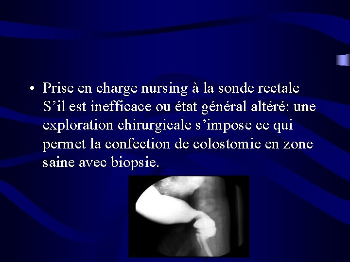  • Prise en charge nursing à la sonde rectale S’il est inefficace ou