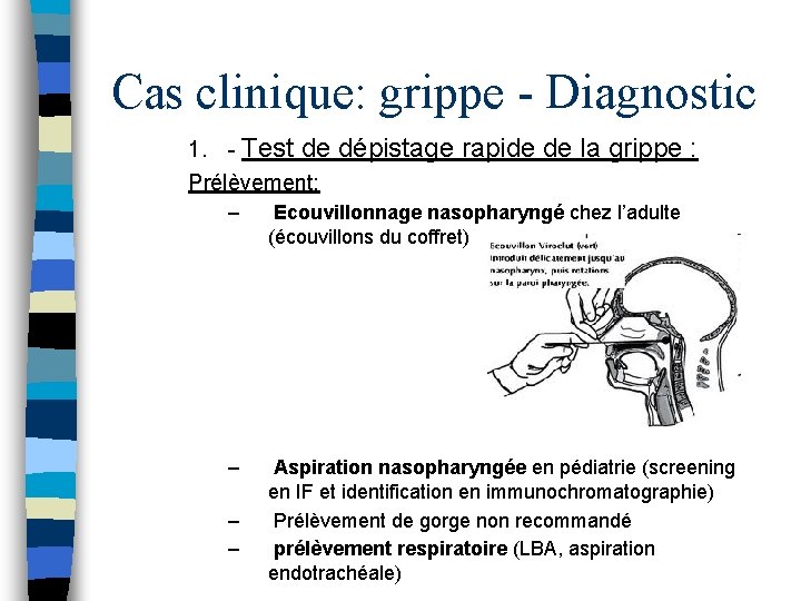 Cas clinique: grippe - Diagnostic 1. - Test de dépistage rapide de la grippe