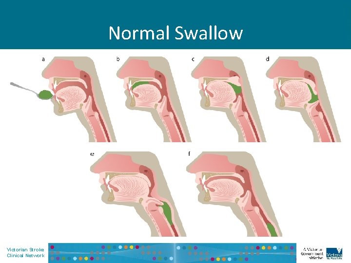 Normal Swallow Victorian Stroke Clinical Network 