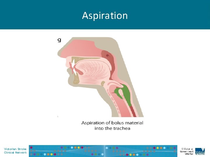 Aspiration Victorian Stroke Clinical Network 