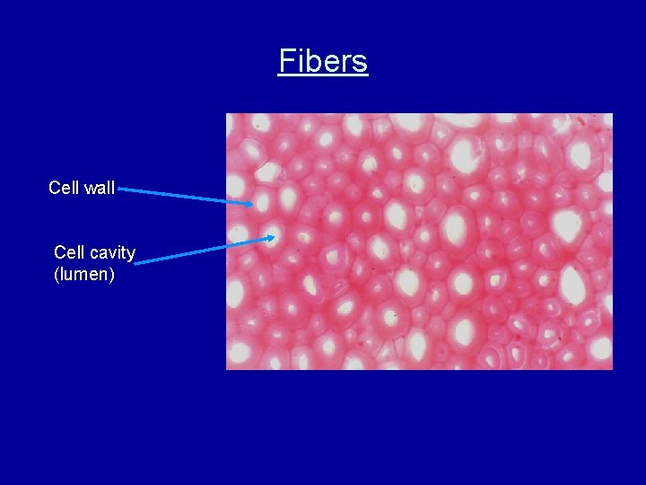 Fibers Cell wall Cell cavity (lumen) 