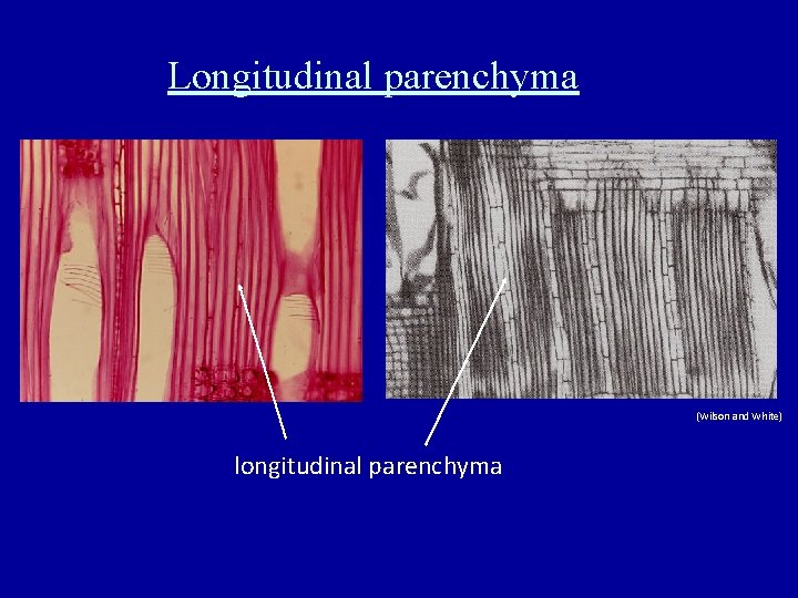 Longitudinal parenchyma (Wilson and White) longitudinal parenchyma 