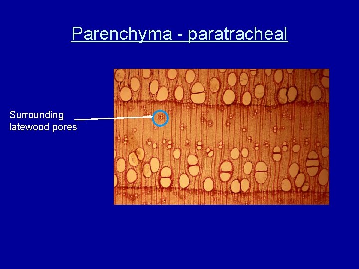 Parenchyma - paratracheal Surrounding latewood pores 