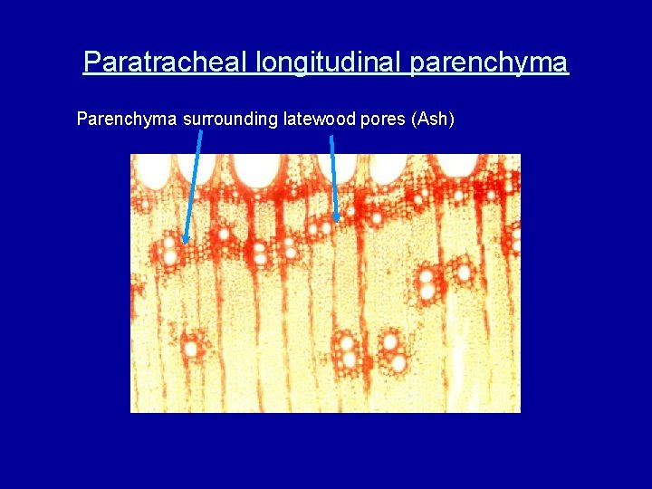 Paratracheal longitudinal parenchyma Parenchyma surrounding latewood pores (Ash) 