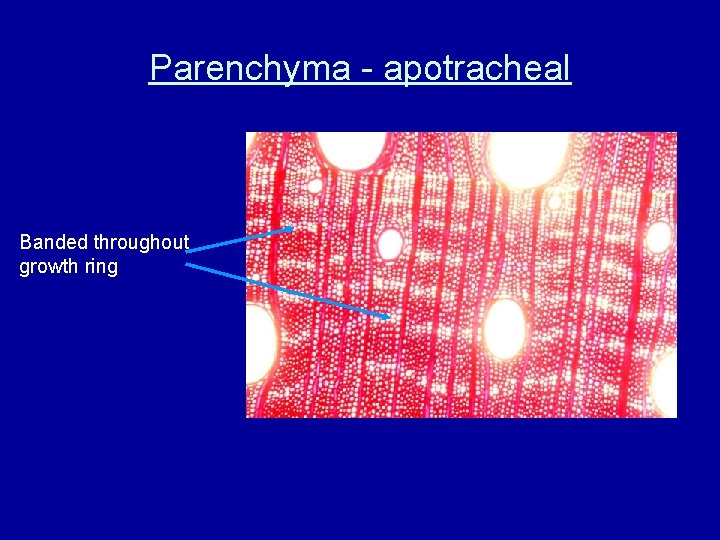 Parenchyma - apotracheal Banded throughout growth ring 