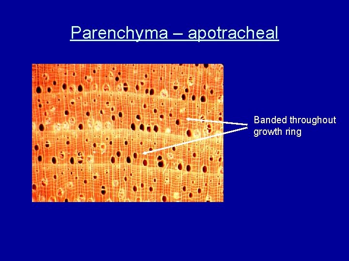 Parenchyma – apotracheal Banded throughout growth ring 