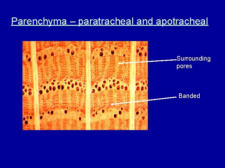 Parenchyma – paratracheal and apotracheal Surrounding pores Banded 