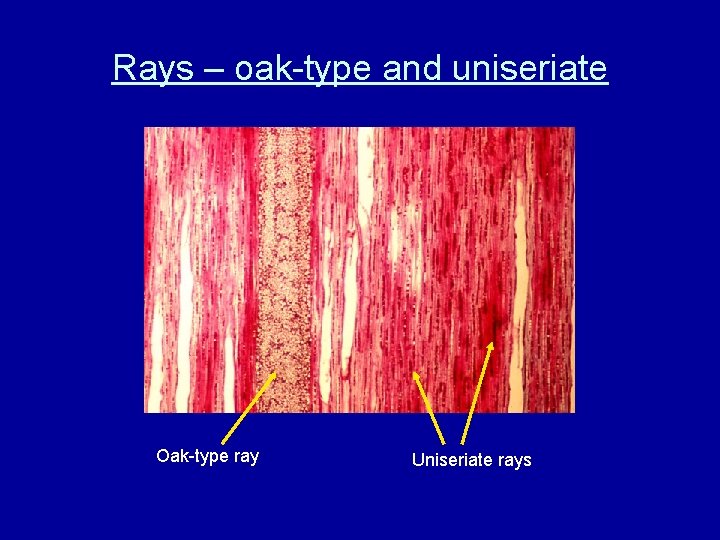 Rays – oak-type and uniseriate Oak-type ray Uniseriate rays 